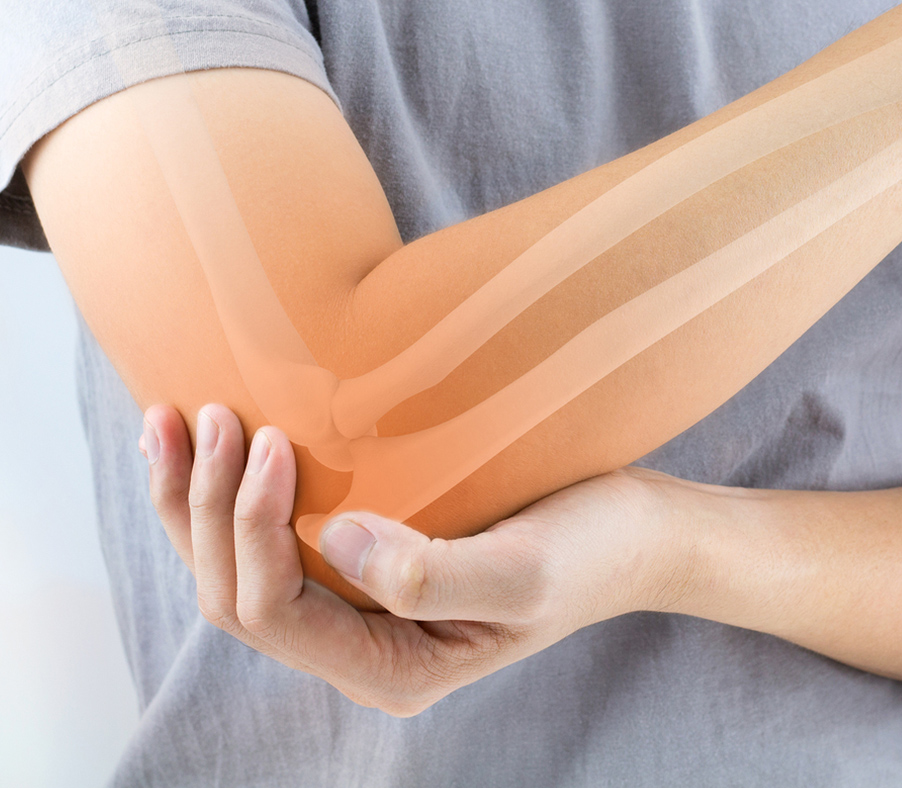 Bagaimana Rontgen Membantu Mendeteksi Patah Tulang